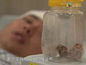 女生胃里消化视频,直观视频带你了解消化奥秘